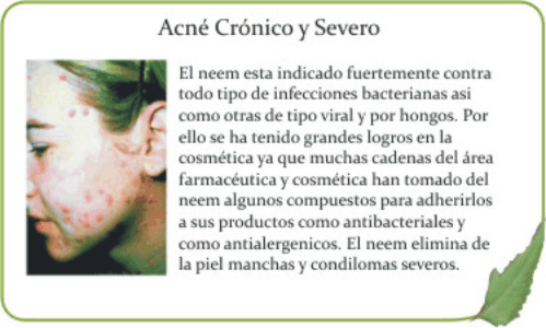 acne.jpg